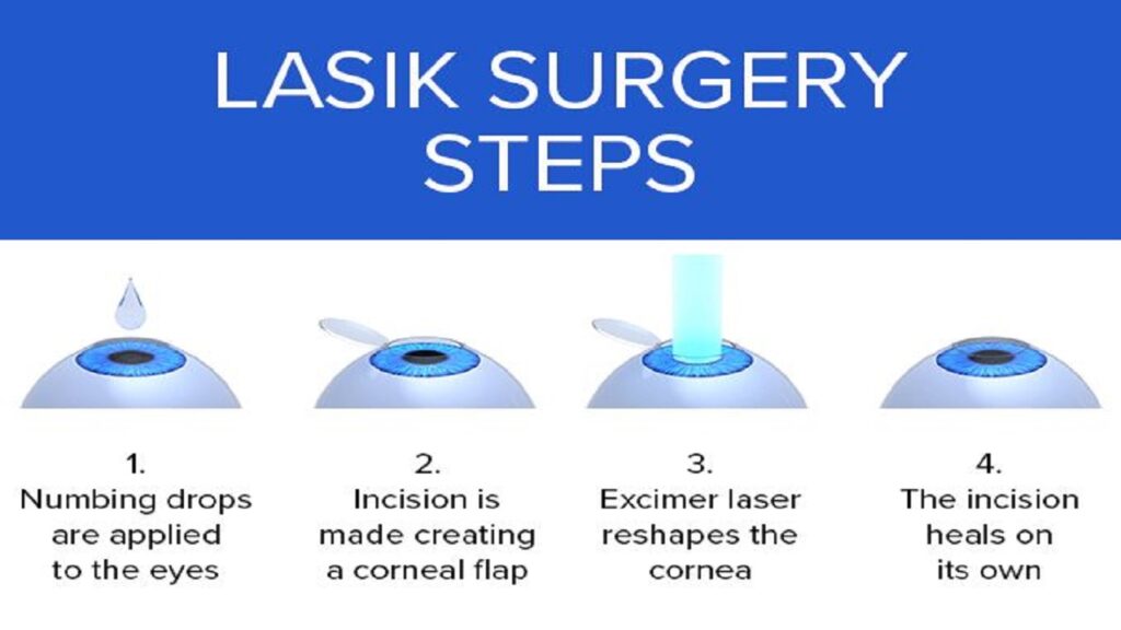 Are all LASIK procedures the same? Which one is the best?